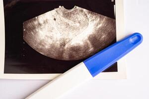 Schwangerschaft Prüfung mit Ultraschall Scan von Baby Gebärmutter, Empfängnisverhütung Gesundheit und Medizin. foto