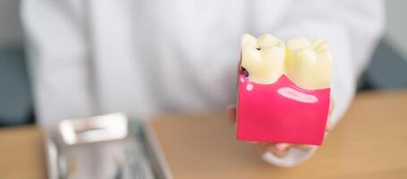 Zahnarzt mit Zahn Anatomie Modell. Oral Zähne zerfallen und Krankheit, kratzen aus Zahnstein. März Oral Gesundheit, Zahnarzt Tag, falsch Zähne. Zahnschmerzen und Kinder Dental Gesundheit Monat und kieferorthopädisch Gesundheit Tag foto