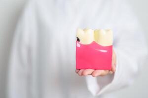 Zahnarzt mit Zahn Anatomie Modell. Oral Zähne zerfallen und Krankheit, kratzen aus Zahnstein. März Oral Gesundheit, Zahnarzt Tag, falsch Zähne. Zahnschmerzen und Kinder Dental Gesundheit Monat und kieferorthopädisch Gesundheit Tag foto