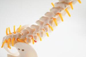 Wirbelsäule Nerv und Knochen, Lendenwirbelsäule Rücken versetzt herniert Rabatt Fragment, Modell- zum Behandlung medizinisch im das orthopädisch Abteilung. foto