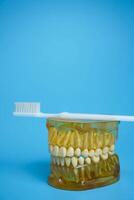 Zahnersatz mit ein Zahnbürste auf ein Blau Hintergrund.oberer und niedriger Kiefer mit falsch Zähne. Zahnersatz oder falsch Zähne, Nahansicht. foto