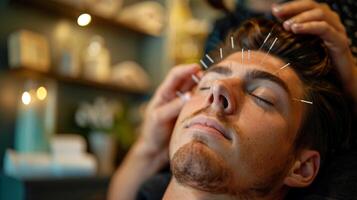ai generiert ein Mann Empfang Akupunktur Therapie Gesicht und Massage im Klinik Spa foto