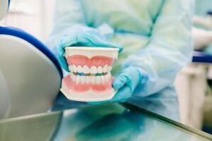 ein Modell- von ein Mensch Kiefer mit Zähne im das Zahnarzt Hand foto