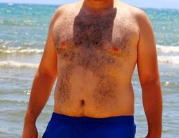 äußerst behaart Körper von ein Fett Mann auf Meer Hintergrund foto