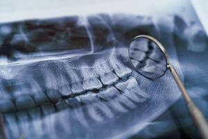 Dental Instrumente und Kiefer Röntgen auf Weiß Hintergrund. Panorama- Kiefer Röntgen auf Weiß Hintergrund. Dental Behandlung Konzept. Nahaufnahme. foto