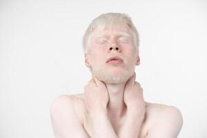 Porträt von ein Albino Mann im Studio gekleidet T-Shirt isoliert auf ein Weiß Hintergrund. abnormal Abweichungen. ungewöhnlich Aussehen foto