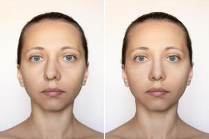 Schuss von ein Frau Gesicht mit Nase Vor und nach Nasenkorrektur isoliert auf ein Weiß Hintergrund. kosmetisch Plastik Chirurgie auf das Nase. Korrektur von das Nasal- Septum. Septumplastik. voll Gesicht schließen oben foto