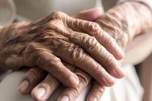 Hand von ältere Frau. Konzept von rheumatoide Arthritis, Arthrose, oder Joint Schmerz. foto