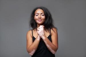 glücklich schwarz Frau mit Vitiligo Krankheit im grau Studio foto