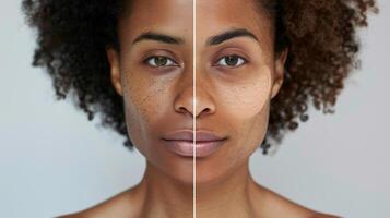 ein Vor und nach Vergleich von ein Personen Haut Transformation nach folgenden ein angepasst Hautpflege Regime foto