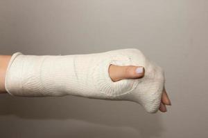 Dame mit gebrochener Hand und Handgelenk in Gips gewickelt foto