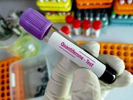 Reagenzglas mit Blutprobe für Quantiferon-Test, Diagnose einer Mycobacterium-Tuberkulose-Infektion foto