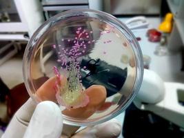 Bakterienkolonie in der Nährbodenplatte. Stuhlkultur, e.coli foto