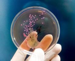 Bakterienkolonie in der Nährbodenplatte. Stuhlkultur, e.coli foto