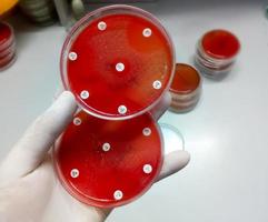 antimikrobielle Empfindlichkeitsprüfung in Petrischale. Antibiotikaresistenz von Bakterien foto