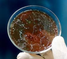 Wissenschaftler oder Arzt mit Petrischale mit Bakterienkolonie. Enterobacter spp. Urinkultur. Ansicht schließen. foto