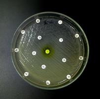 antimikrobielle Empfindlichkeitsprüfung in Petrischale. Antibiotikaresistenz von Bakterien foto