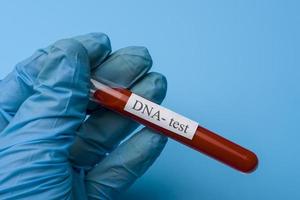 Hand, die einen DNA-Test in einem Reagenzglas auf blauem Hintergrund hält. foto