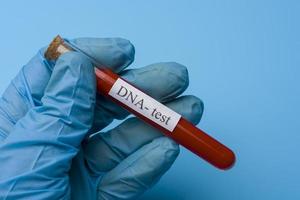 Hand, die einen DNA-Test in einem Reagenzglas auf blauem Hintergrund hält. foto