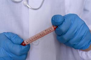 hände in medizinischen handschuhen, die einen test auf das coronavirus halten. foto