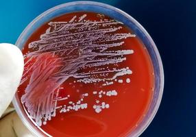 Staphylococcus aureus, grampositiv, bis gramvariabel, unbeweglich, Coccus, Beta-Hämolyse, saprotrophes Bakterium, das zur Familie der Staphylococcus-Wachstum auf Blutagar gehört. foto