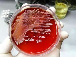 Staphylococcus aureus, grampositiv, bis gramvariabel, unbeweglich, Coccus, Beta-Hämolyse, saprotrophes Bakterium, das zur Familie der Staphylococcus-Wachstum auf Blutagar gehört. foto