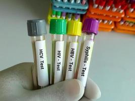 Blutproben für den Test auf sexuell übertragbare Krankheiten. hcv, hiv, hbv, syphilis. Standard foto