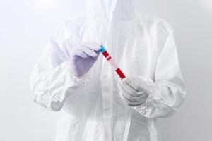 coronavirus-bluttest, arzt, der reagenzgläser hält, medizintechnik foto