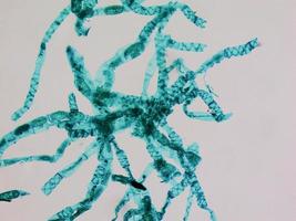 Spirogyra-Zellen mikroskopische Aufnahme foto