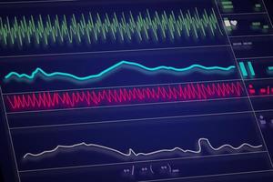 patientenmonitor mit vitalzeichen ekg und ekg. Vektor-Illustration. foto