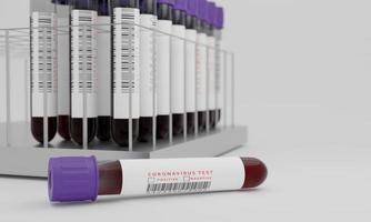 Reagenzgläser mit Blut- und Coronavirus-Testetikett isoliert auf weißem Hintergrund. konzept zum testen des corona-virus. 3D-Rendering. foto