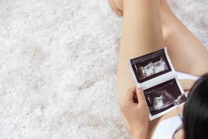 schwangere frau, die ultraschallbild hält konzept der schwangerschaft foto