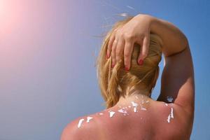 Frau reibt Sonnencreme auf seiner Schulter. vor dem Hintergrund des Meeres. foto