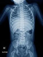 Röntgenbild des Kindes foto