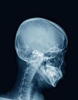 röntgen menschlicher schädel in blau foto