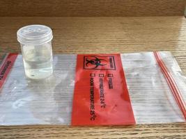 Urinprobe in transparenter Plastikflasche foto