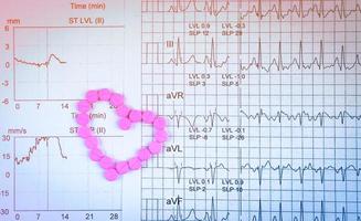 ekg- oder ekg-elektrokardiogramm-diagrammpapier. est-belastungstestergebnis und rosa herzform aus warfarin-tablettenpillen. warfarin pinke Tabletten zur Behandlung von Vorhofflimmern. foto