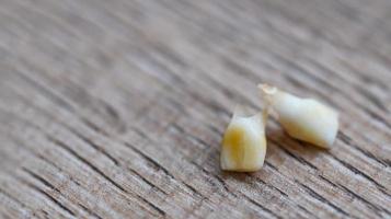 Milchzahn, Nahaufnahme von Milchzähnen von Zahnverlust auf Holz, Konzept von Milchzahnzahngesundheitsproblemen foto