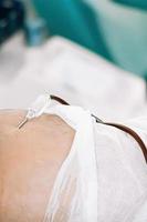 Katheter in der Vene Nahaufnahme. internationaler blutspendetag. Spender spendet Blut, um Leben zu retten. foto