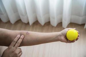 weicher Finger- und Handübungsball in geduldiger Hand - medizinisches Konzept im Gesundheitswesen foto