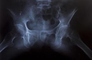 Röntgenbild der menschlichen Brust für eine medizinische Diagnose