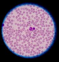 medizinische Blutzellen. foto