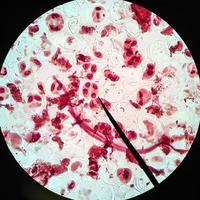 lebende gesunde Zellen (Mitose) foto