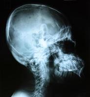 Röntgenaufnahme des Kopfes foto