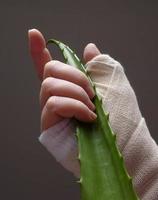 Hand mit Verband, der Aloe Vera Blatt hält foto