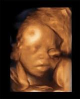 Ultraschall des Babys in der schwangeren Frau foto