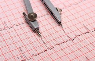 Elektrokardiogramm-Diagrammbericht und Bremssättel foto