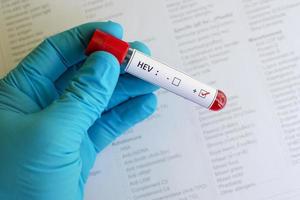 Hepatitis-E-Virus (Hev) positiv