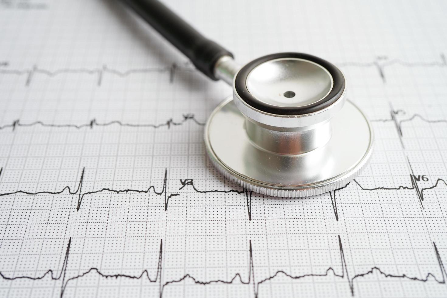stetoskop på elektrokardiogram med läkemedel, hjärtvåg, hjärtinfarkt, kardiogramrapport. foto
