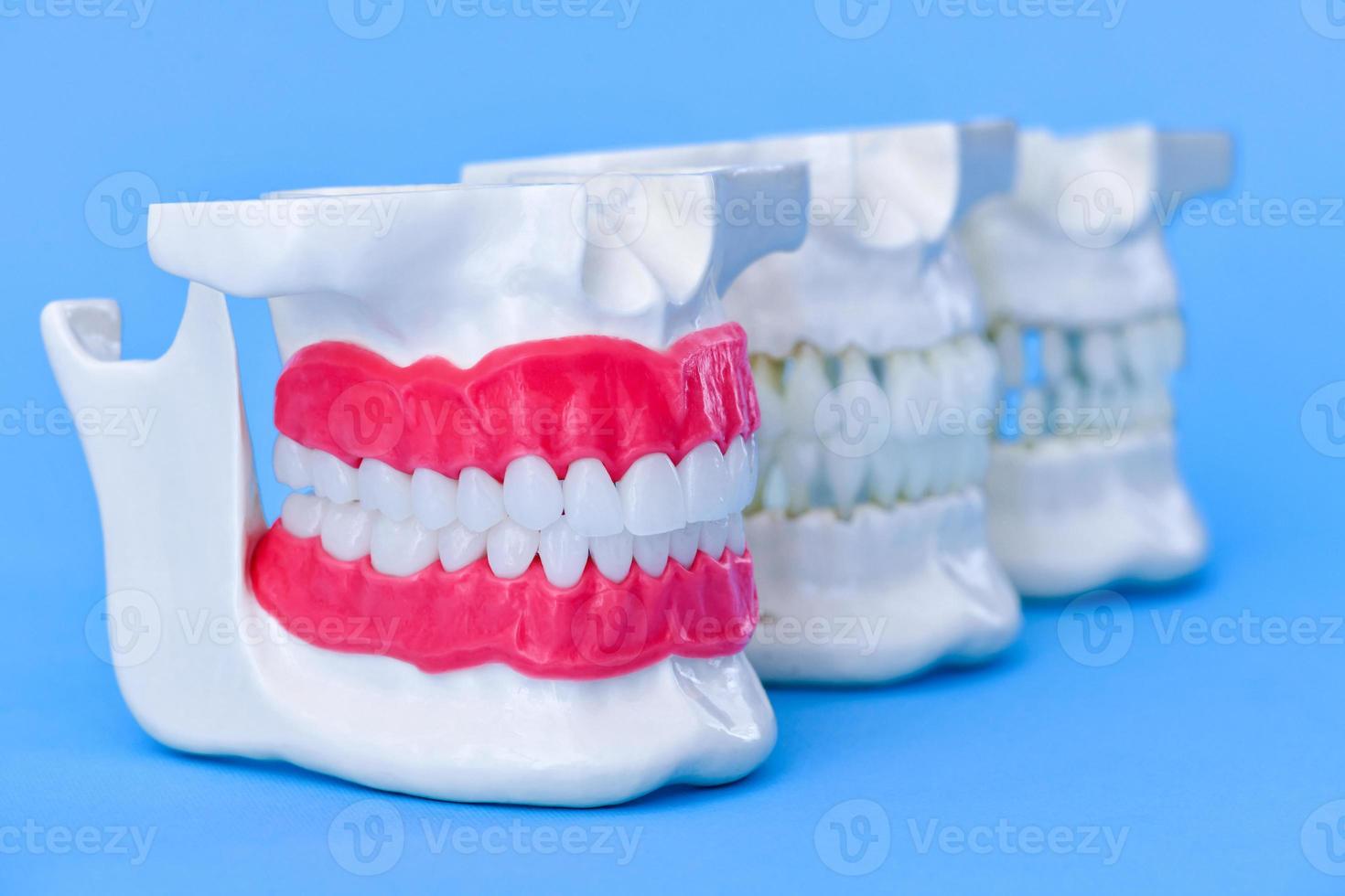 mänsklig käftar med tänder och tandkött anatomi modeller foto